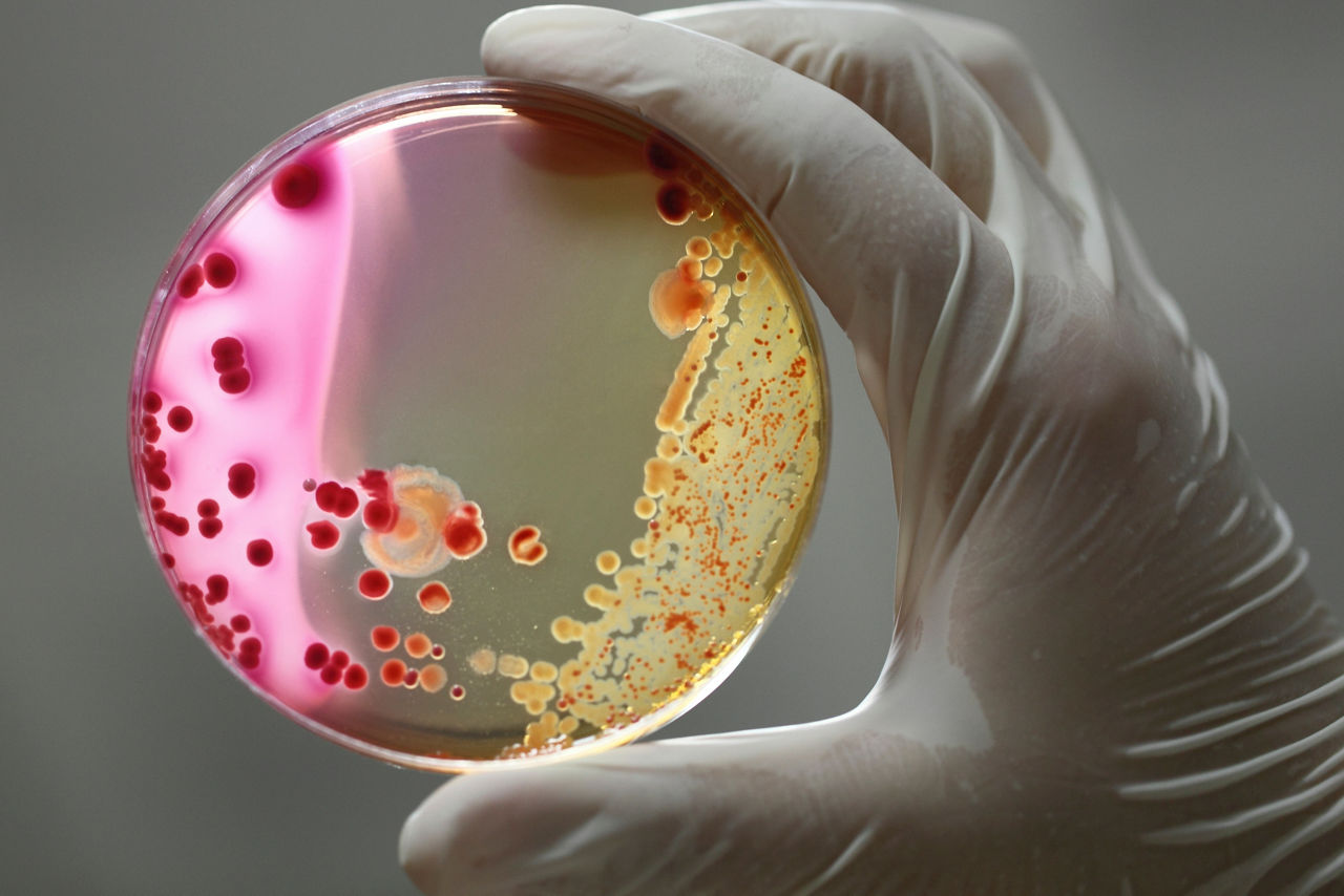 Bacteria macro photographed media in petri dishes in the laboratory