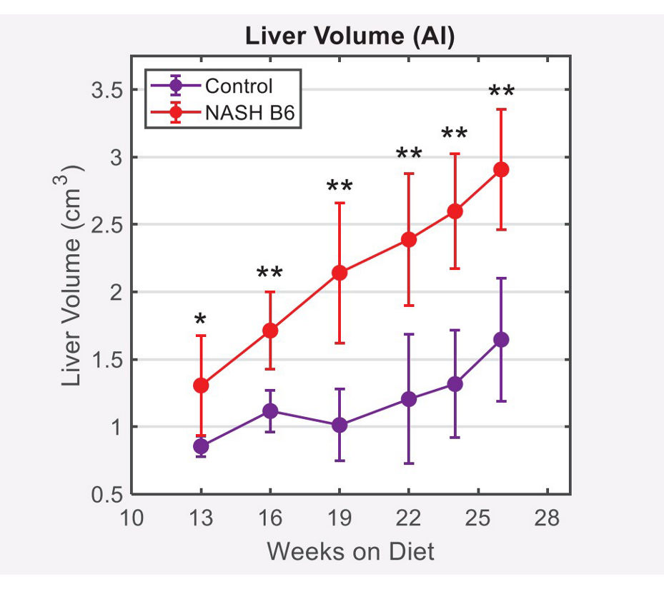 liver volume