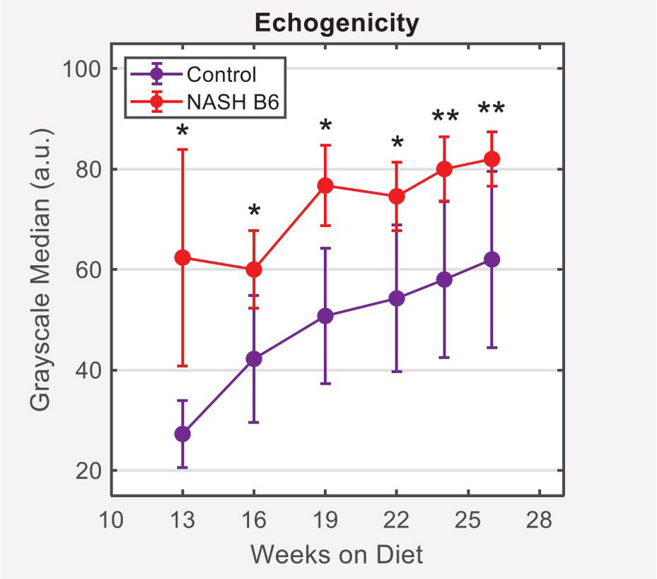 echogenicity